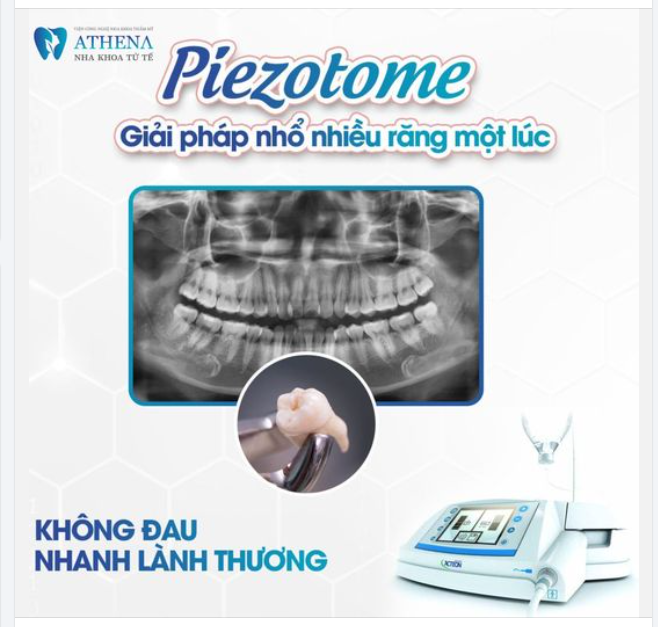 ĐƠN GIẢN VỚI MÁY PIEZOTOME TẠI NHA KHOA DOREMI