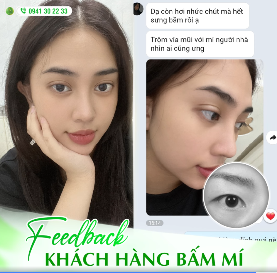 THAY ĐỔI ĐÔI MẮT CỰC KÌ TỰ NHIÊN VỚI GIẢI PHÁP BẤM MÍ MULTIDEEP