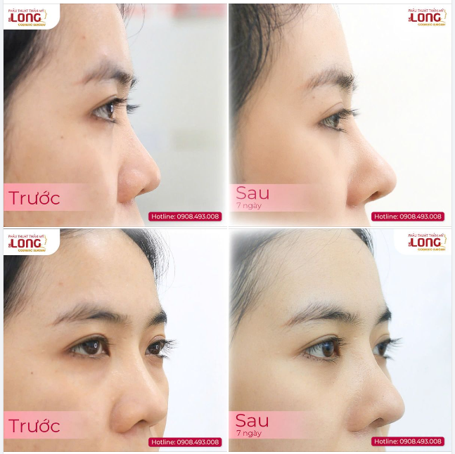 Khách hàng chứ không phải thượng đế mà cứ đến đòi NÂNG