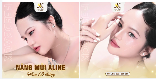 CHUYÊN MỤC FEEDBACK MŨI XINH