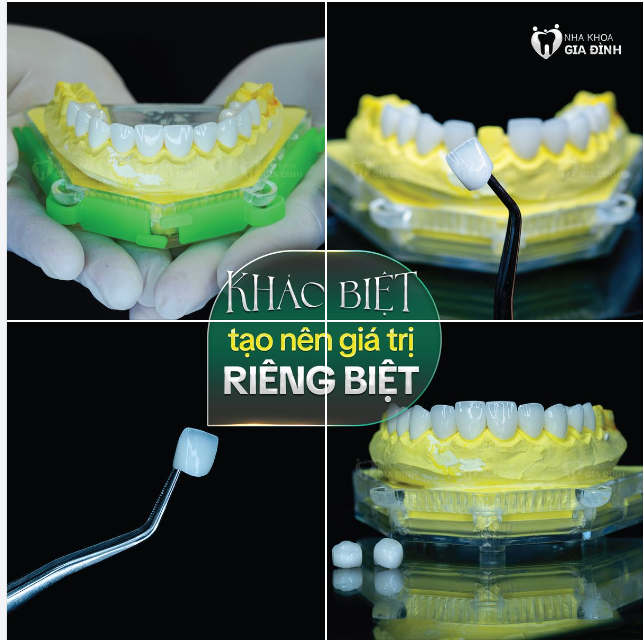 KHÁC BIỆT TẠO NÊN GIÁ TRỊ RIÊNG BIỆT NHA KHOA GIA ĐÌNH - KIẾN TẠO NỤ CƯỜI ĐỘC BẢN