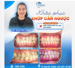 KHẮC PHỤC KHỚP CẮN NGƯỢC CÙNG KH M.PHƯƠNG