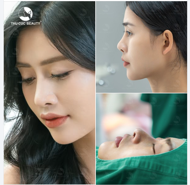 Muốn gương mặt có điểm nhấn đến ngay TC để dáng mũi cao thon 