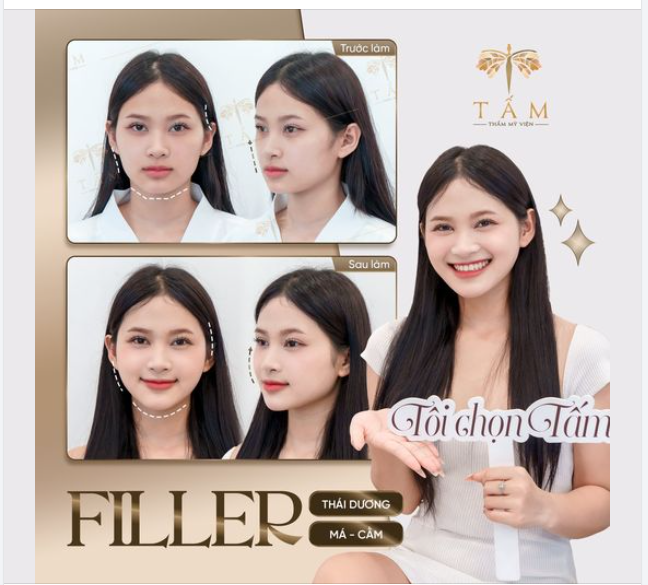 "Mình không nghĩ chỉ 30 phút thôi mà đã khác biệt như này!" - Chia sẻ của khách hàng Kim Thuỳ. Cằm ngắn lẹm, thái dương hóp, hốc má bị hõm sâu đã khiến chị Thuỳ từng rất tự ti nhưng chị đã thay đổi rõ rệt. Vùng má trở nên đầy đặn baby h