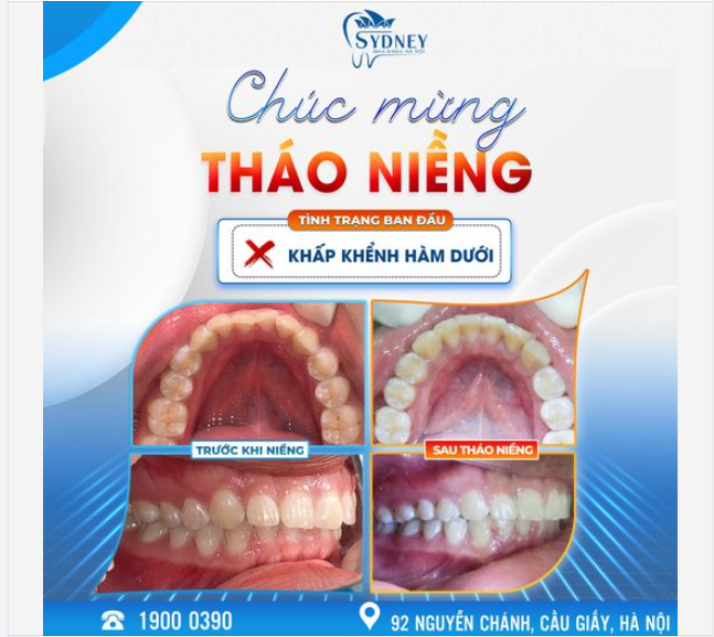 CHÚC MỪNG THÁO NIỀNG KH. HỒNG OANH