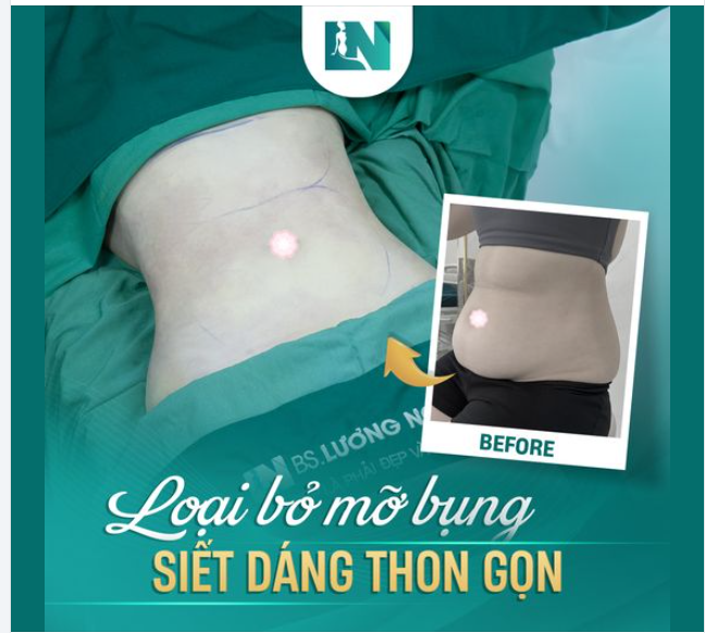 TẠM BIỆT BỤNG MỠ - EO THON HẾT CỠ