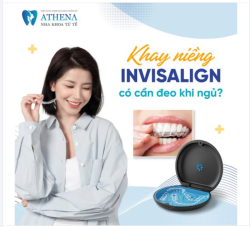 Có cần đeo khay niềng invisalign khi ngủ hay không?