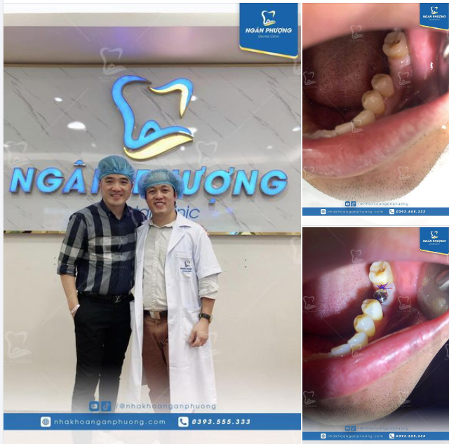 Hoàn thành cắm trụ cho ca sĩ Dương Ngọc Thái. Mà tối cắm xong vẫn hát ngọt như mía lùi