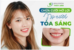 CHIA TAY KHUYẾT ĐIỂM BIẾN ĐỔI NỤ CƯỜI, ''TĂNG TỐC XINH ĐẸP'' DỊP CUỐI NĂM