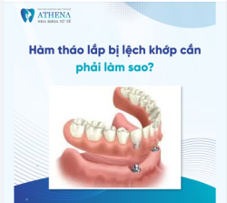 Hàm tháo lấp bị lệch khớp cắn phải làm sao?