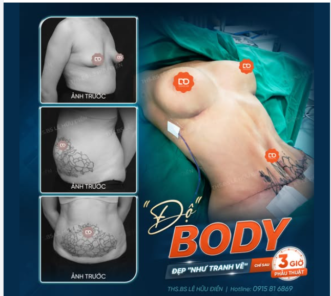 "Độ" body đẹp "như tranh vẽ" chỉ sau 3h phẫu thuật!