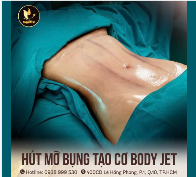 HÚT MỠ BỤNG TẠO CƠ SIẾT EO BODY JET