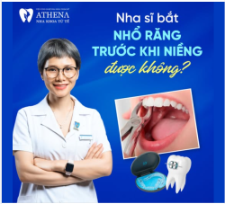 Khi bạn quyết định niềng răng, một trong những câu hỏi phổ biến mà nhiều người thắc mắc là liệu có cần nhổ răng trước khi niềng hay không.