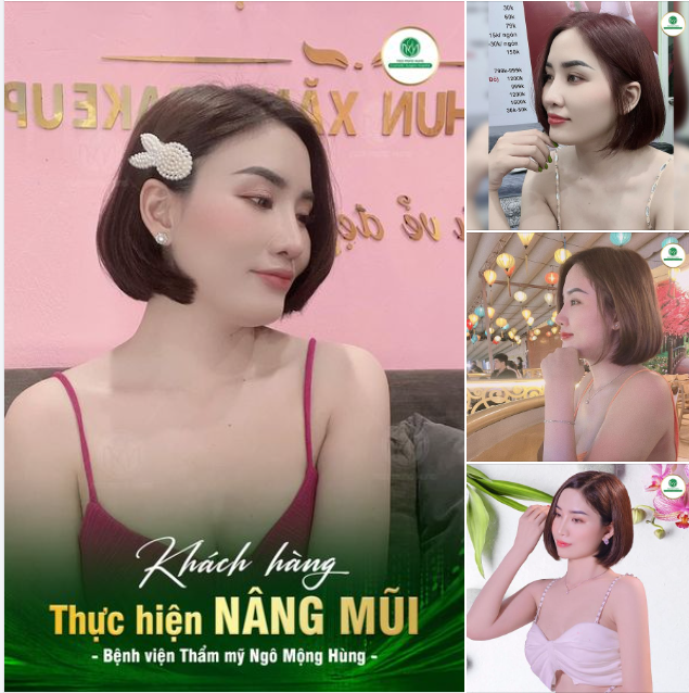THỨ 7 NHẸ NHÀNG Ngắm dáng mũi đẹp xem nàng có bị “đổ gục” hay không nhé!