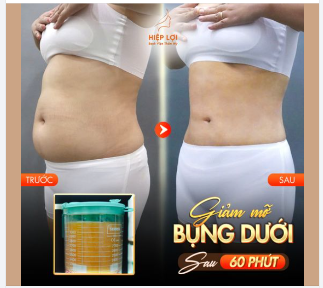 GIẢM MỠ HIỆU QUẢ - AN TOÀN TUYỆT ĐỐI