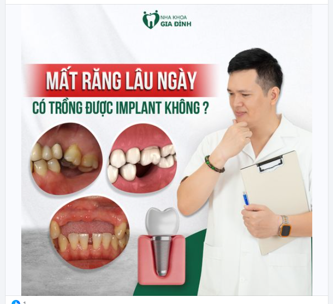 "RĂNG MẤT LÂU NGÀY CÓ TRỒNG IMPLANT ĐƯỢC KHÔNG ?