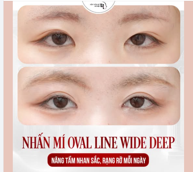Sở hữu ĐÔI MẮT TO TRÒN CUỐN HÚT chỉ sau 30 phút