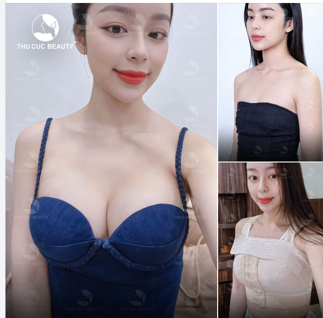 Byby V1 lép xệ lệch size chỉ sau 60P thực hiện