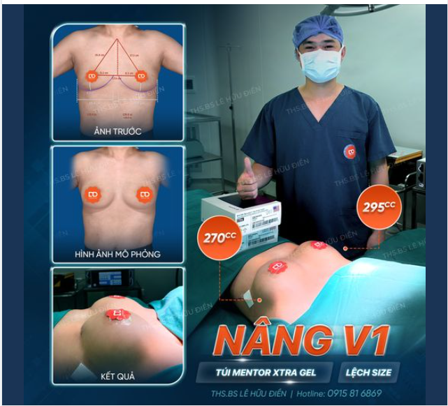 LÝ DO BẠN KHÔNG THỂ BỎ QUA CÔNG NGHỆ VECTRA XT PLUS TRONG QUÁ TRÌNH TƯ VẤN NÂNG V1