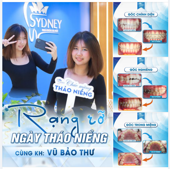 RẠNG RỠ NGÀY THÁO NIỀNG CÙNG CÔ NÀNG BẢO THƯ