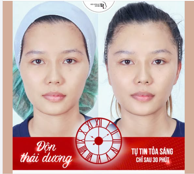 ĐỘN THÁI DƯƠNG - GƯƠNG MẶT THANH TÚ