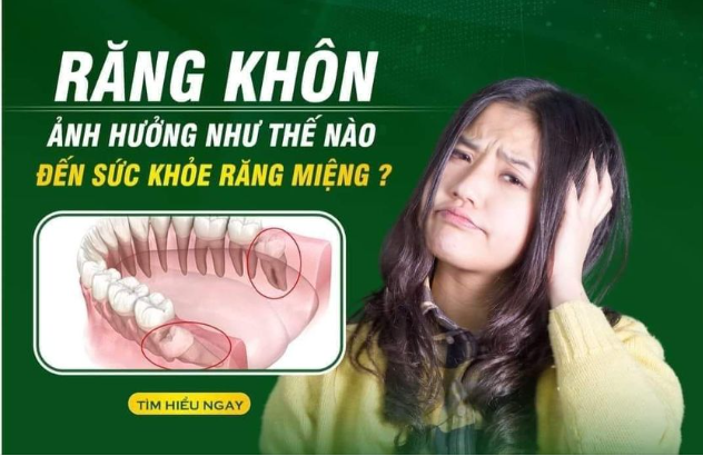 RĂNG KHÔN ẢNH HƯỞNG NHƯ THẾ NÀO ĐẾN SỨC KHỎE RĂNG MIỆNG?