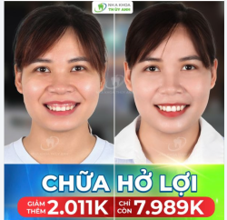 CƯỜI TƯƠI KHÔNG LO HỞ LỢI, SẴN SÀNG CHO NHỮNG KHOẢNH KHẮC ĐÁNG NHỚ CUỐI NĂM