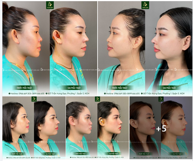 Khách tranh thủ làm đẹp chơi TẾT!!