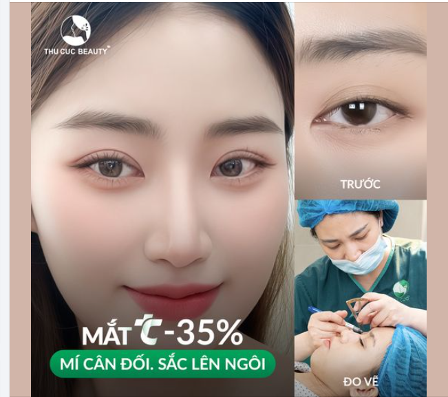 Nhưngc ai  bị mí sụp/ mí lệch/ mí đa nếp Chọn Mắt TC