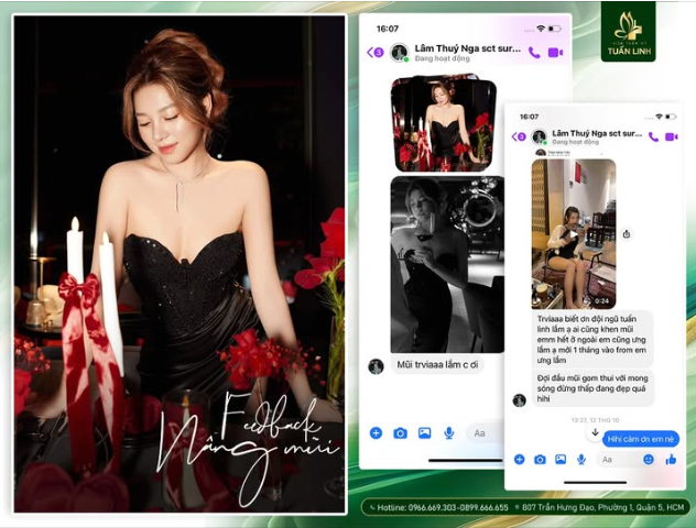 ''Mũi 1 tháng vào form xinh lắm, ai cũng khen hết" - Chia sẻ của khách hàng sau 1 tháng nâng mũi siêu cấu trúc Surgiform!!