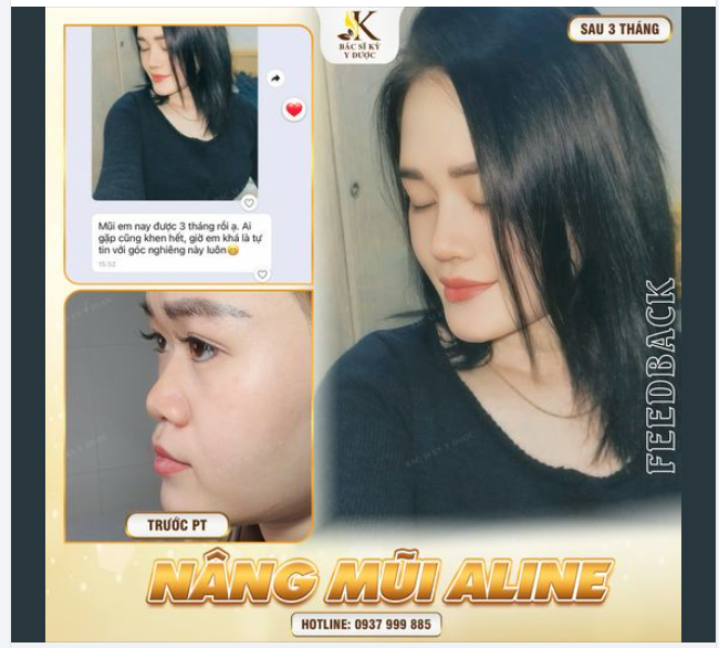CHUYÊN MỤC FEEDBACK MŨI XINH