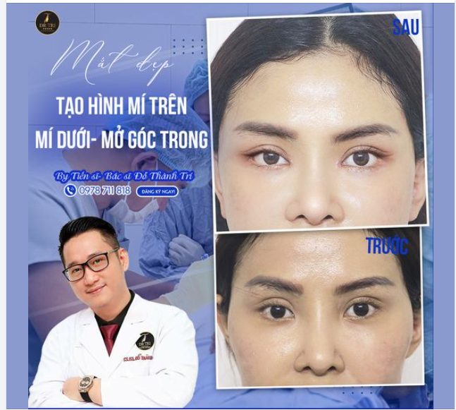 MẮT ĐẸP THÁNG 10