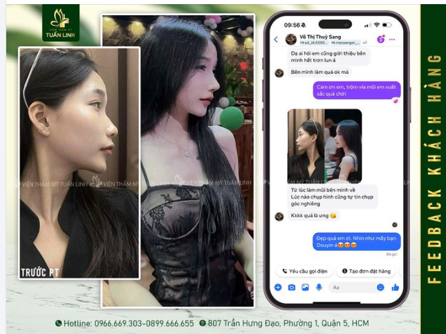ĐỔI GÓC NGHIÊNG THAY DIỆN MẠO ĐẸP CUỐN HÚT!!