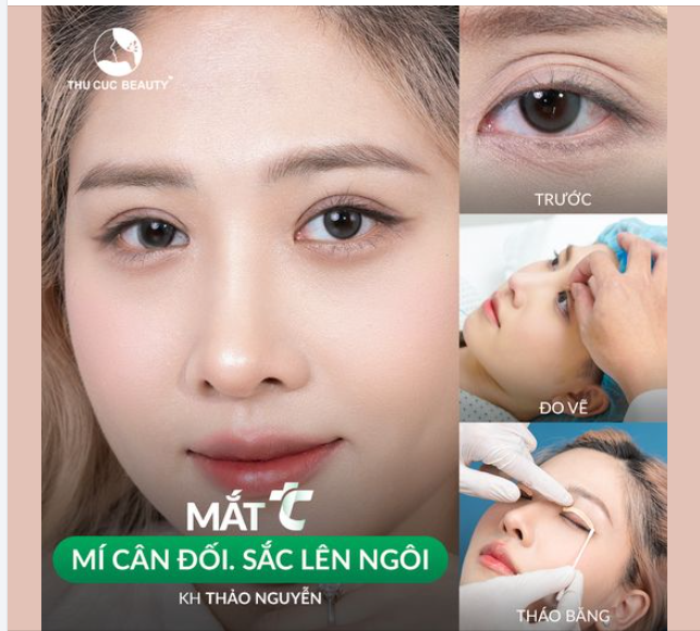 Sắc đẹp lên ngôi ngại chi cắt mí