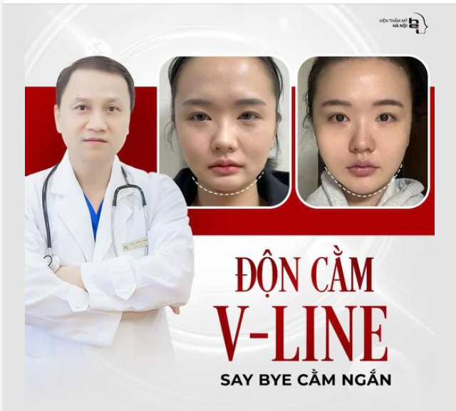 ĐỘN CẰM VLINE - SAY BYE CẰM NGẮN