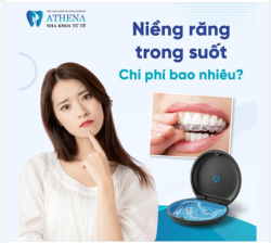 Niềng răng Invisalign giá bao nhiêu?