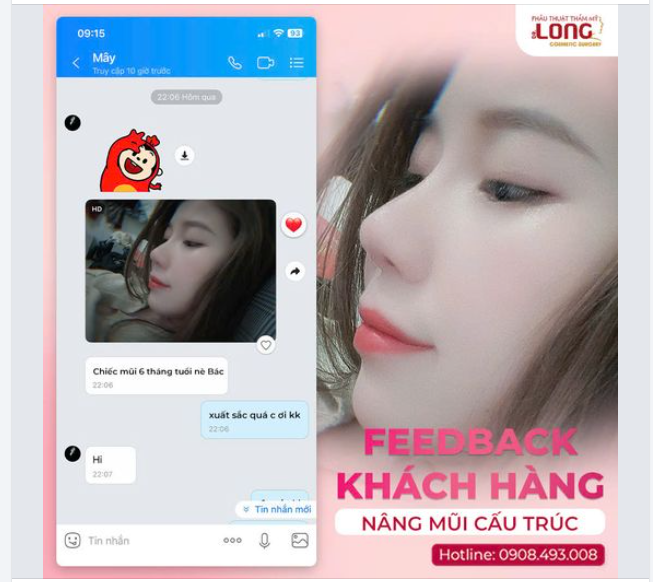 MỘT CHIẾC MŨI SIÊU IU TỪ VỊ KHÁCH SIÊU SLAY