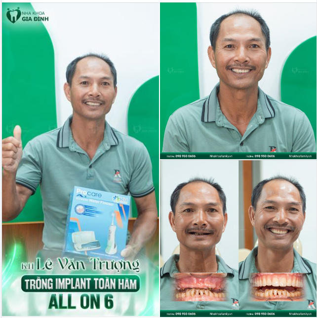 HÀNH TRÌNH TÌM LẠI NỤ CƯỜI CỦA CHÚ LÊ VĂN TRƯỢNG VỚI IMPLANT ALL ON 6