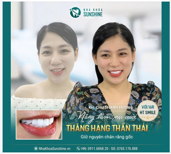 NÂNG TẦM NỤ CƯỜI - THĂNG HẠNG THẦN THÁI
