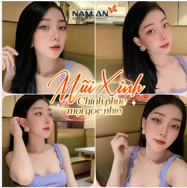 MŨI XINH CHINH PHỤC MỌI GÓC NHÌN