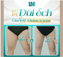 HÚT MỠ ĐÙI - LÙI SỐ ĐO CHỈ 60 PHÚT THỰC HIỆN