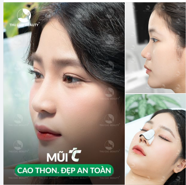 Dáng mũi cao sẽ giúp khuôn mặt bạn thay đổi 180 độ