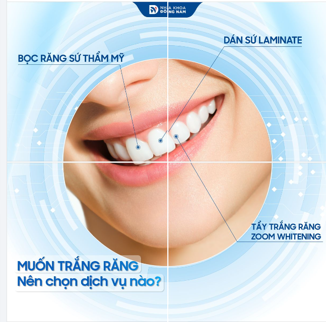 Bọc răng sứ, dán sứ và tẩy trắng răng đâu mới là lựa chọn phù hợp nhất giúp bạn sở hữu hàm răng trắng sáng đều màu?