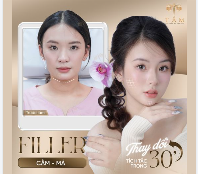 "Mình bị Mặt to - Má hõm - Cằm lẹm đang không biết phải làm sao?" - Thì dành 30 phút với Combo Thon Gọn Hàm - Filler làm đầy Má - Cằm sẽ thay đổi được điều này!