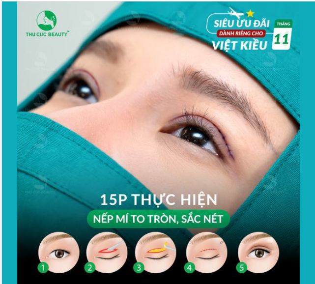 Quà tăng cho các chị em Tặng ngay đến 5 chỉ vàng 9999 cho KH Việt Kiều đặt lịch cắt mí trong tháng 11