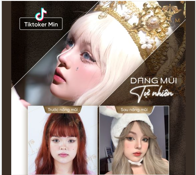 Có ai mê dáng mũi tự nhiên như Min không ạ, nhắn tin ngay để được bác sĩ chuyên khoa thẩm mỹ tư vấn và thăm khám trực tiếp nhé!!!