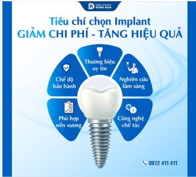 HƯỚNG DẪN CHỌN TRỤ IMPLANT CHẤT LƯỢNG, GIÁ TỐT