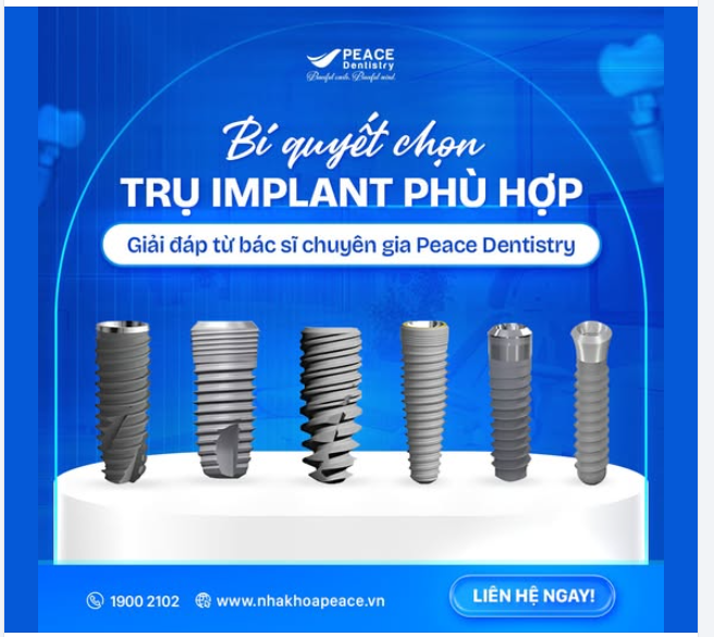 NÊN CHỌN IMPLANT NÀO ĐỂ VỪA ĐẢM BẢO HIỆU QUẢ VỪA PHÙ HỢP VỚI TÀI CHÍNH?