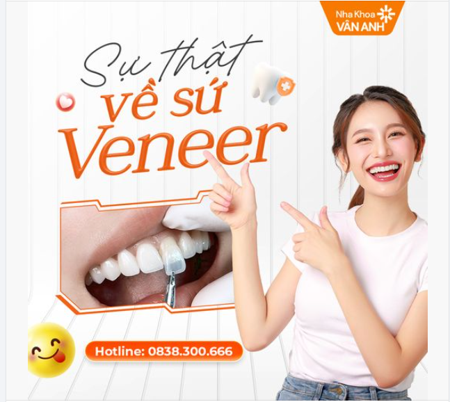 Những sự thật về mặt dán sứ Veneer mà bạn chưa biết!