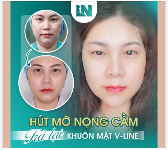 SỞ HỮU MẶT GỌN TRẺ XINH - GÓC NGHIÊNG THẦN THÁNH